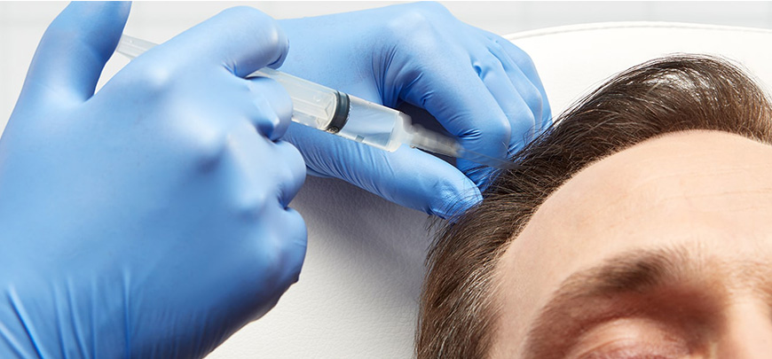 Mezoterapiyle Saçınızı Güçlendirebilirsiniz