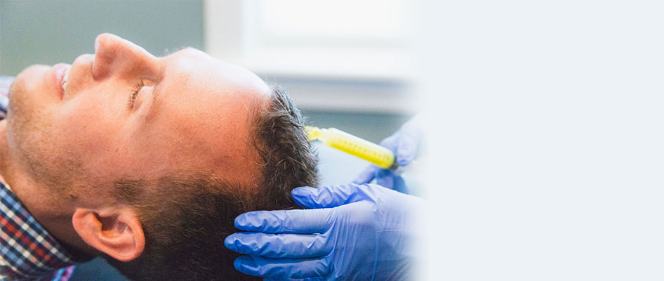 Feeding FUE®-Haartransplantation